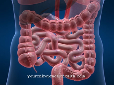 Intestinal stenosis