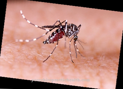 קדחת Dengue