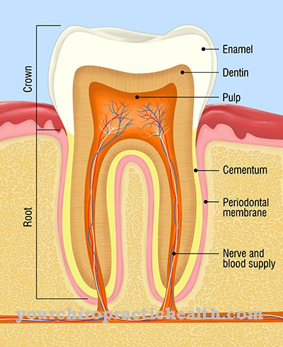 Dentinogenesis imperfecta