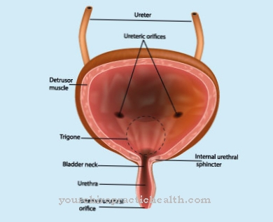 Dyssynergia detruzora-zvierača