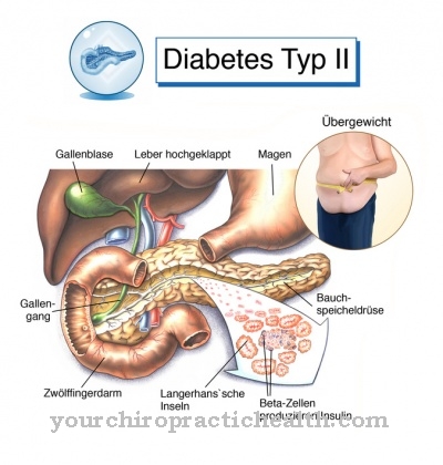 2. típusú diabetes mellitus