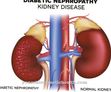 Diabetikus nephropathia