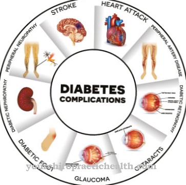 Diabetic neuropathy