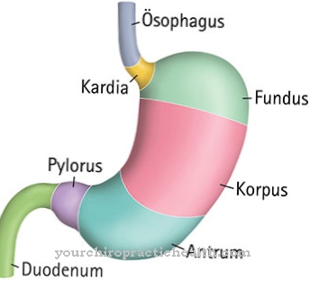 Diffuse esophageal spasm