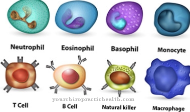 Diffuse B-cell lymphoma