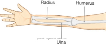 Distal humeral fracture