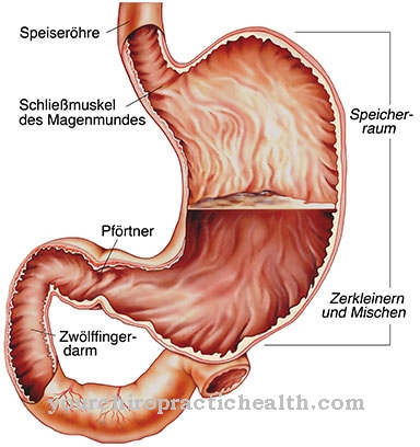 Dumping syndrome