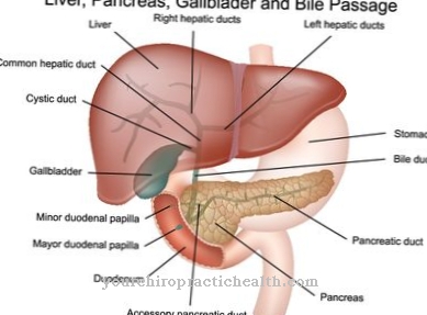 Duodenitis