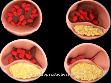 Circulatory disorders