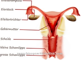 Fallopian tube rupture