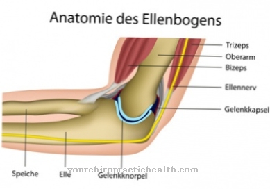 Knækket albue