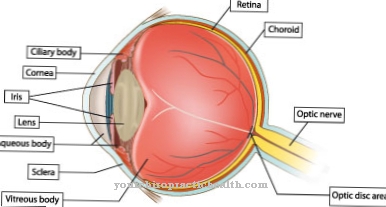 Endofthalmitis