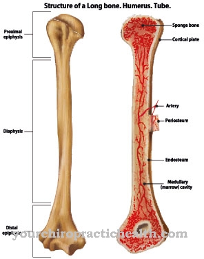 Engelmann syndrome