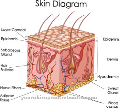 Epidermolisis bulosa