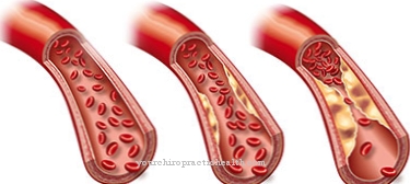 Increased fat levels in the blood