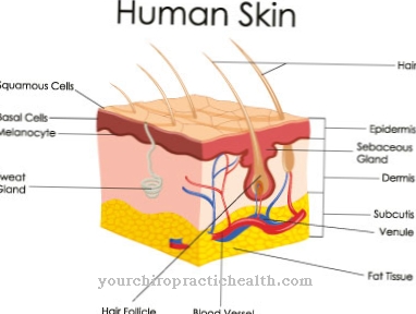 Erythema nút (hồng nốt)