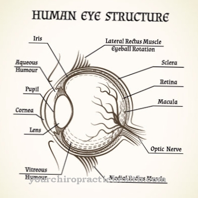 Exophthalmos