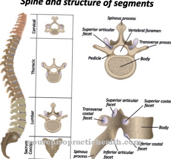 Facet syndrome