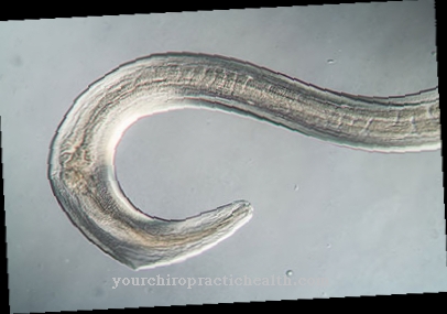 Roundworm infection