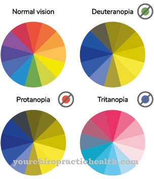 Color blindness