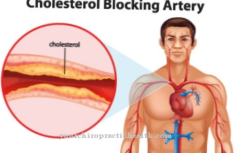 Disturbo del metabolismo dei lipidi