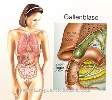 Inflammation of the gallbladder