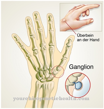 Ganglion (chân trên)