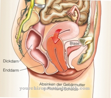 Abaissement de l'utérus (dépression vaginale)