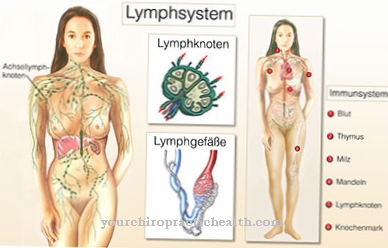 Vascular malformation