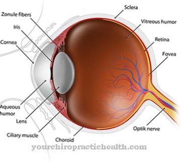 Vitreous hemorrhage