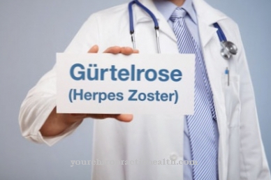 herpes zoster