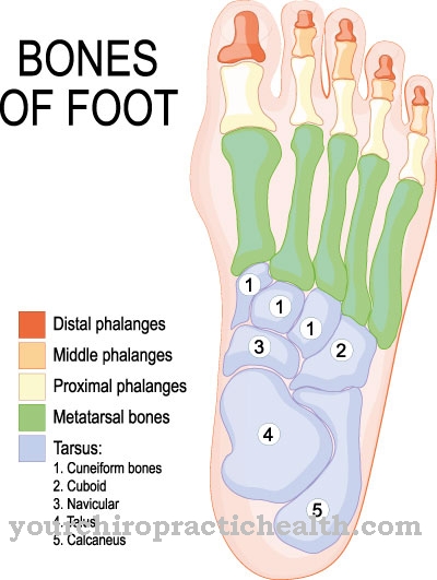 Hallux rigidus