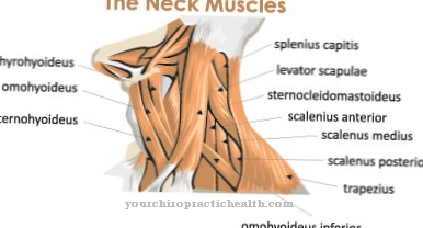 Cervical rib syndrome