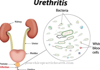 Upala uretre (uretritis)