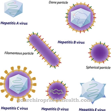 Hepatitis E.