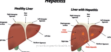 hepatitida