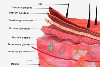 Queratosis palmoplantar hereditaria