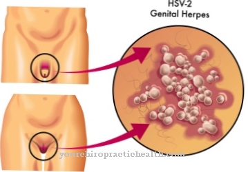 Herpes genitale (herpes genitale)