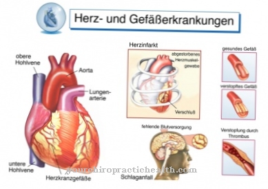 Boli cardiovasculare