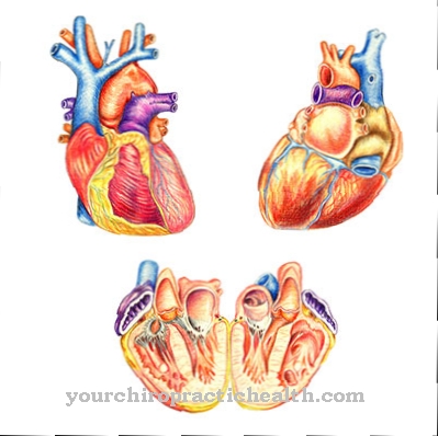 Pericarditis