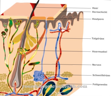 Hidradenitis süpürativa