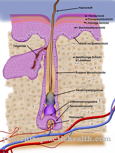 Hidrocitoma