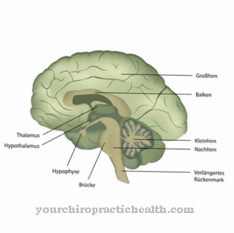 Brain abscess (brain abscess)