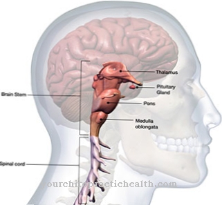 Brain stem syndrome