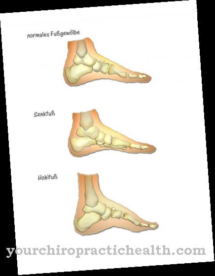 Kaki lengkung