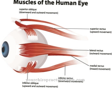 Horner syndrome