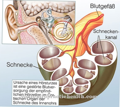 Sudden hearing loss