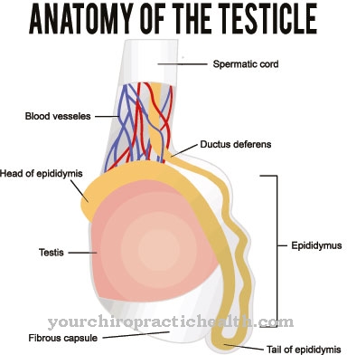 Hydrocele (water fracture)