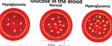 Hyperglycemia