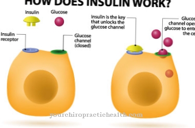 Hyperinsulinism